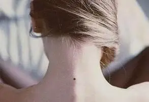 女人脖子右侧有痣代表什么呢