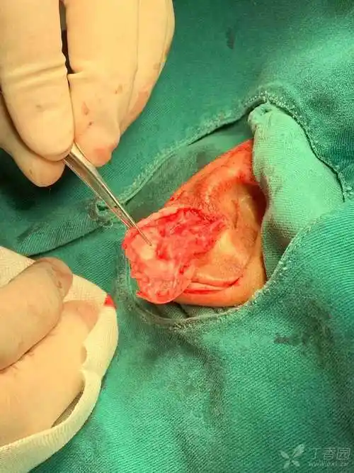 耳朵后面长疙瘩,几种原因不可大意!_大全-幸福起航