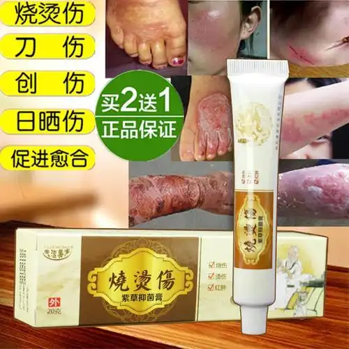 藏王烫烧伤膏成人儿童开水烫伤湿润膏刀伤创伤伤口愈合膏日晒伤修复霜