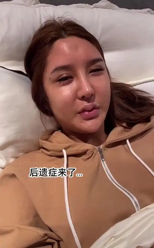 16岁开始整容,花费上百万,短短几年打了400针玻尿酸,她怎样了