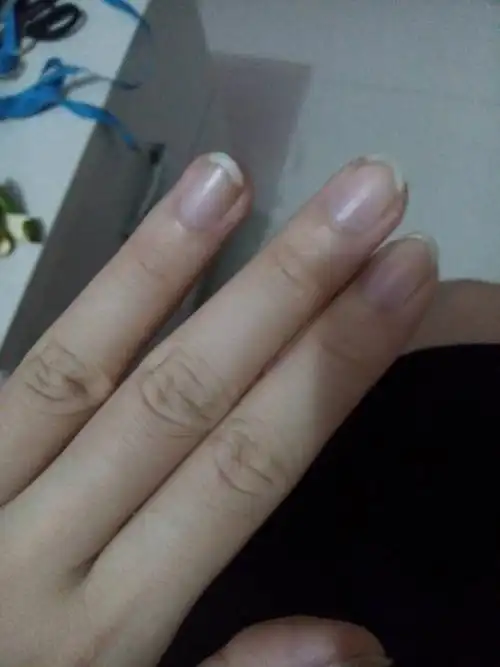 问:为啥指甲有点乌紫乌紫的