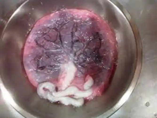 人胎盘详细的特征图片