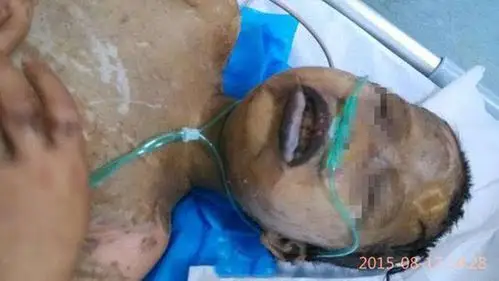 偷吃零食悬吊致死盘点那些令人震惊的虐童事件图