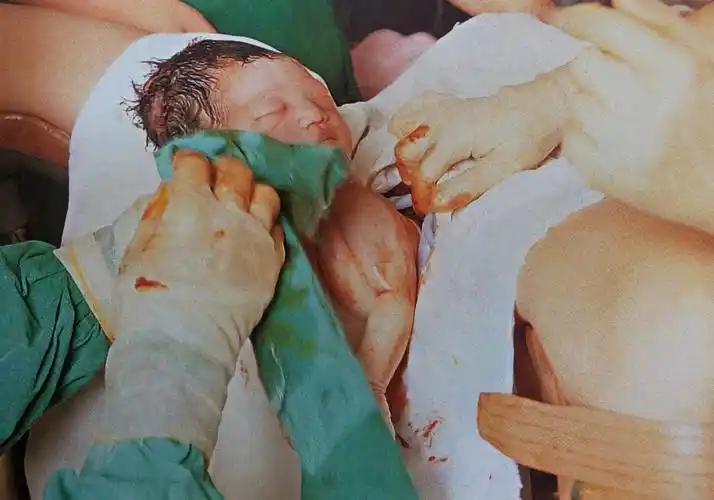 孕妇生孩子全过程|真人图-搜狐