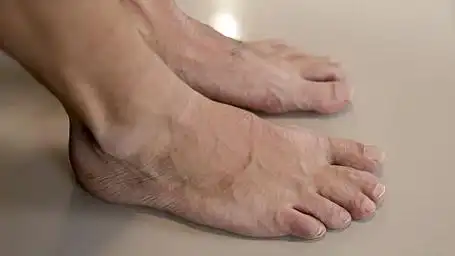 脚酸是常见现象