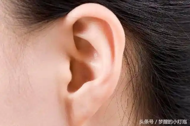 3种天降富贵的好耳朵,你占了几条?