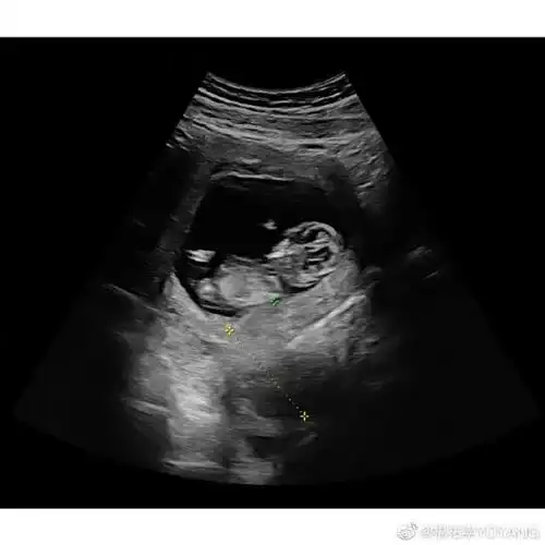 宣布升级当爸:"我和我的未婚妻malinda,准备进入人生的下一个阶段