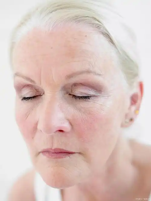 女性衰老时,典型表现有皮肤变薄,暗沉粗糙,皱纹增多等.