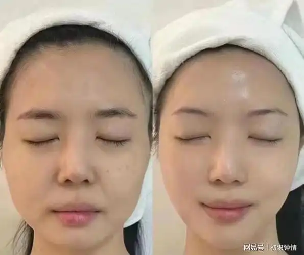 抗皱产品哪个好盘点四大抗皱产品