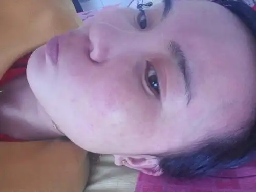 南京皮肤过敏的常见症状有哪些? - 南京华肤皮肤病医院