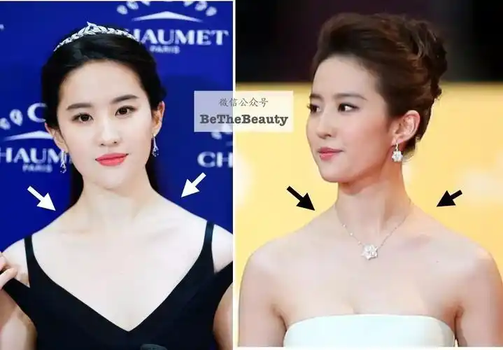 颜值过硬如刘亦菲,虽然有天鹅长颈,但斜方肌明显,溜肩感强:除了p腿,另