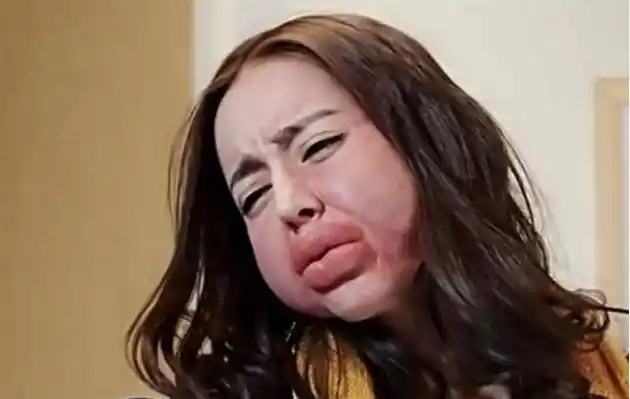 说到我们的新晋女神迪丽热巴,她也在电视里扮过丑相,因为花粉过敏导致