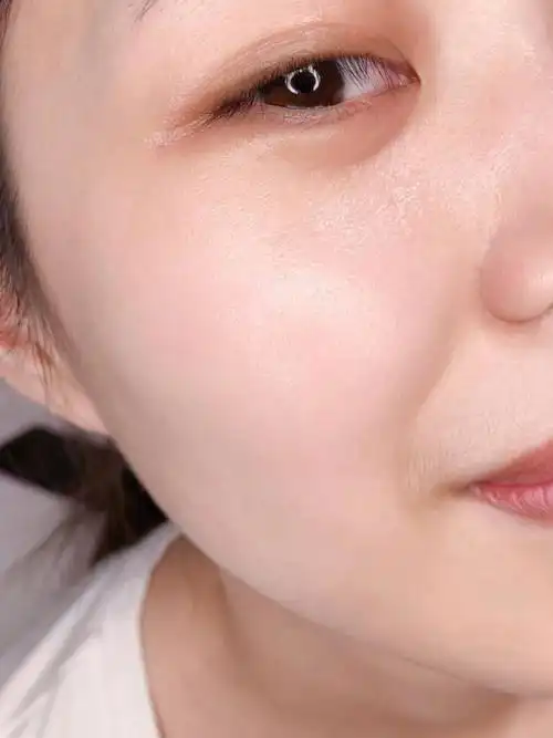 怕了重组人凝胶脸蛋不到1个月就这样了