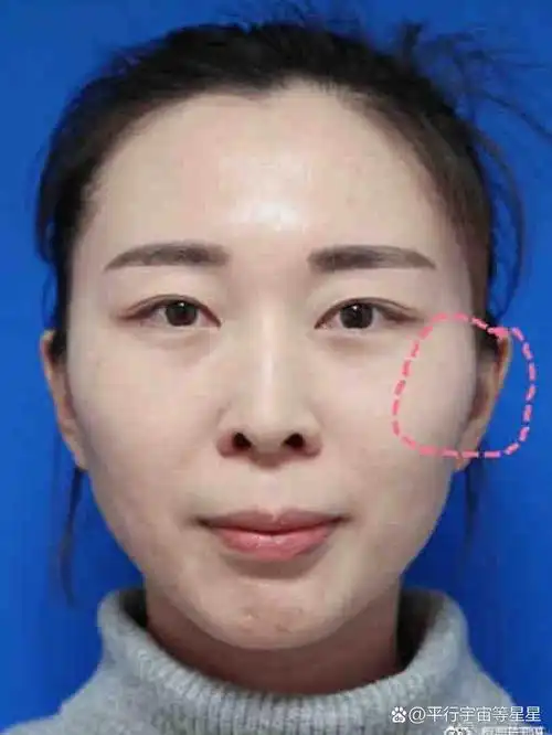 女人颧骨高到底是好还是坏?