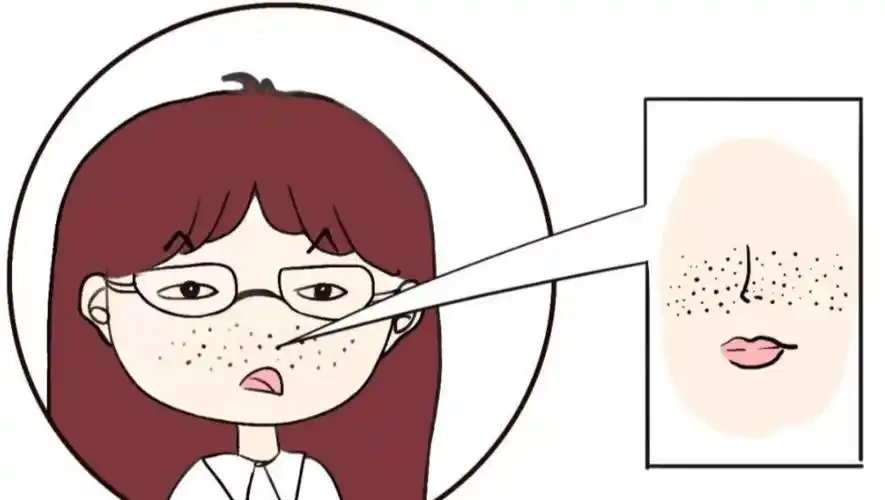 毛孔粗大有办法缩小吗?