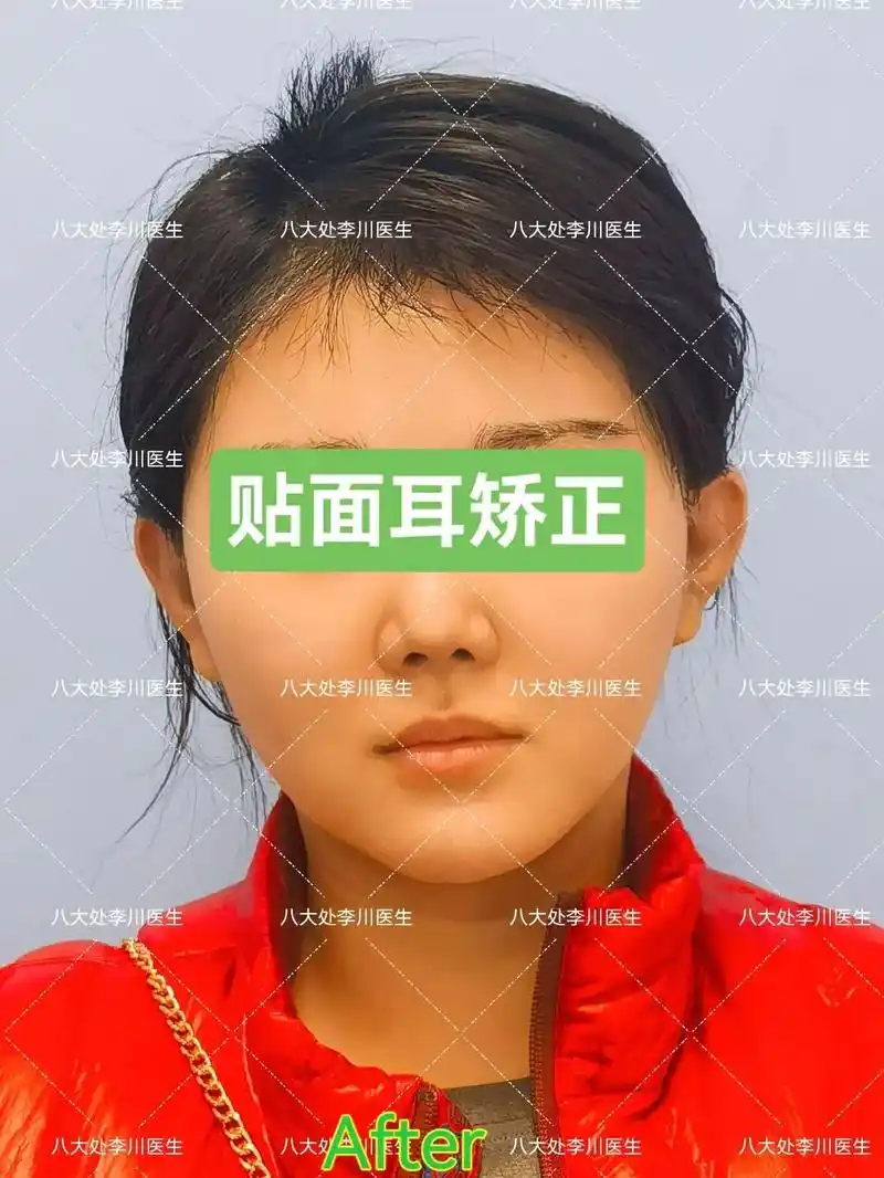 多数东方人认为大耳有福,耳朵适当凸出,耳垂饱满是 - 抖音