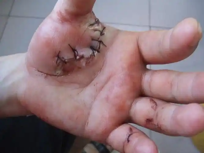 [景点]血染沱江---天涯网友湖南凤凰行被当时人砍伤