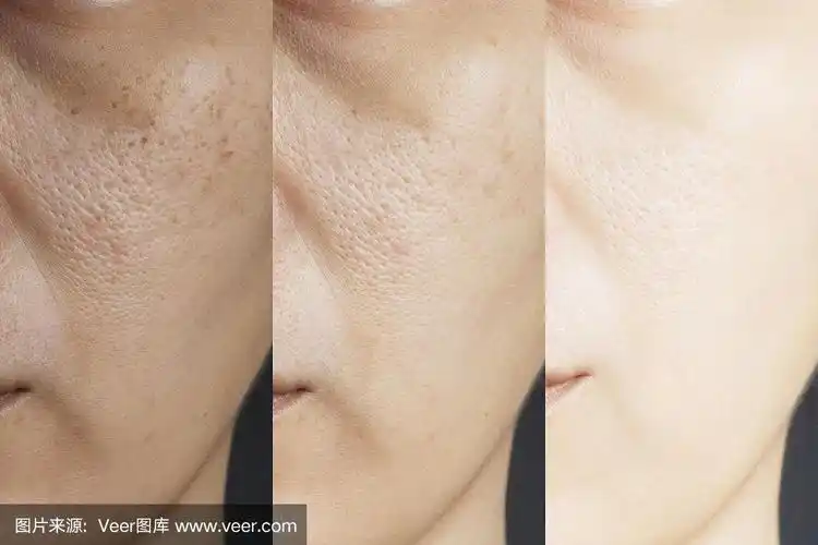 三张照片对比治疗前后疗效.