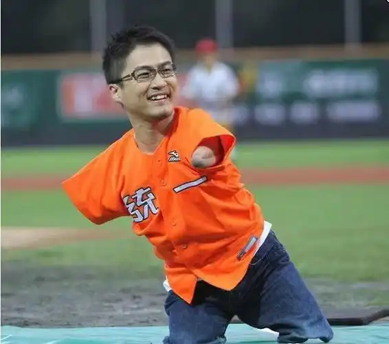 日本作家"海豹人"婚内出轨50人,网友称奇,无腿劈腿王?