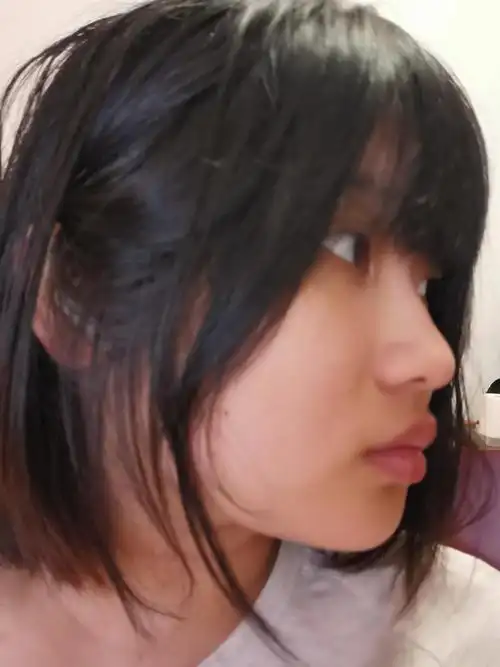 求教(慎入)请问我的侧脸问题出在龅牙上吗