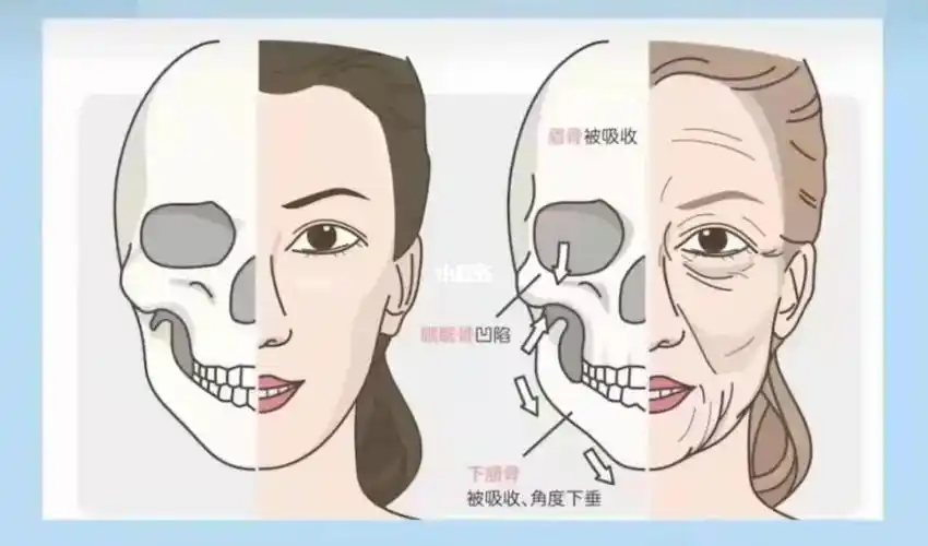 要想从根本抗衰老,先让骨骼复位固定