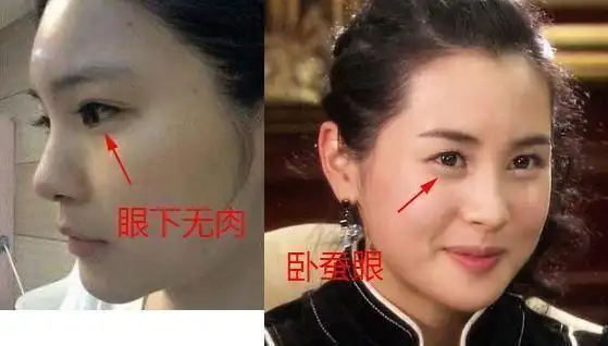 面相口诀:眼下无肉,子女不足,眼睛有这个特征的人子嗣难旺
