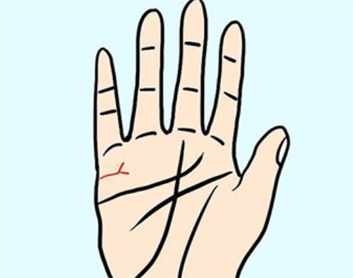 婚姻线附近有颗痣代表什么 婚姻线上面有颗痣是什么意思-善吉网