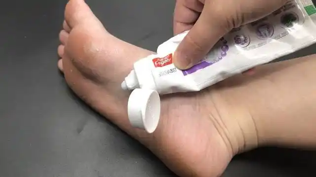 睡觉前,在脚底抹点牙膏真厉害,好多人不懂有啥用,早点告诉家人