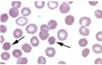 那些年曾经被混淆过的红细胞