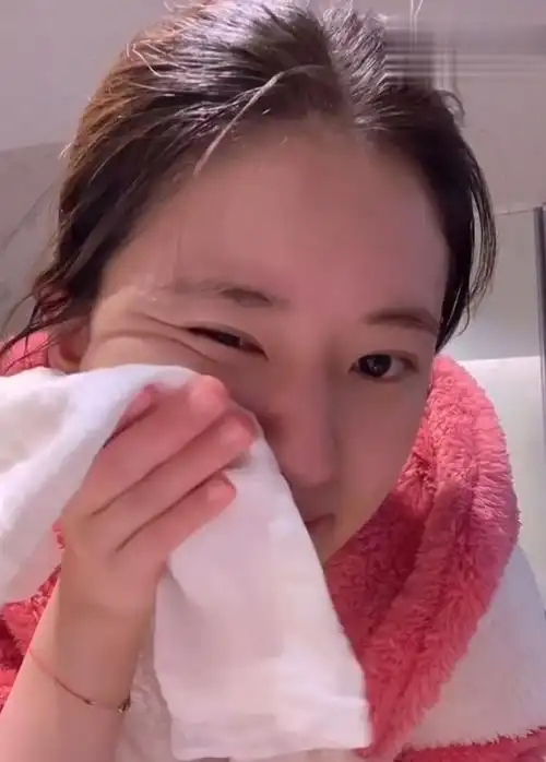 有种素颜叫赵露思卸妆洗完脸露出素颜状态她真有24岁吗