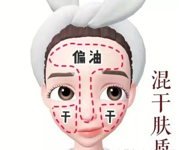 混合性皮肤护理知识