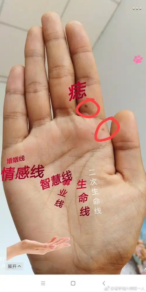 评论区抽中食指位置长痣 此人 偏财运超级.