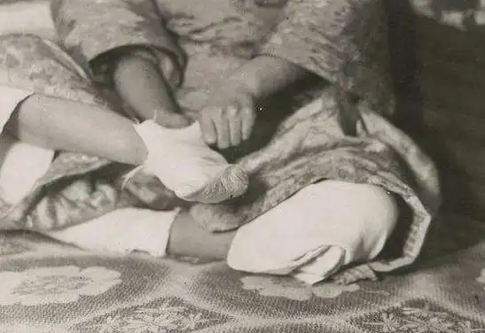 红楼梦也有被缠足的吗?