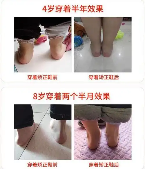 3岁宝宝走路内八字怎么办,孩子三岁了右脚走路