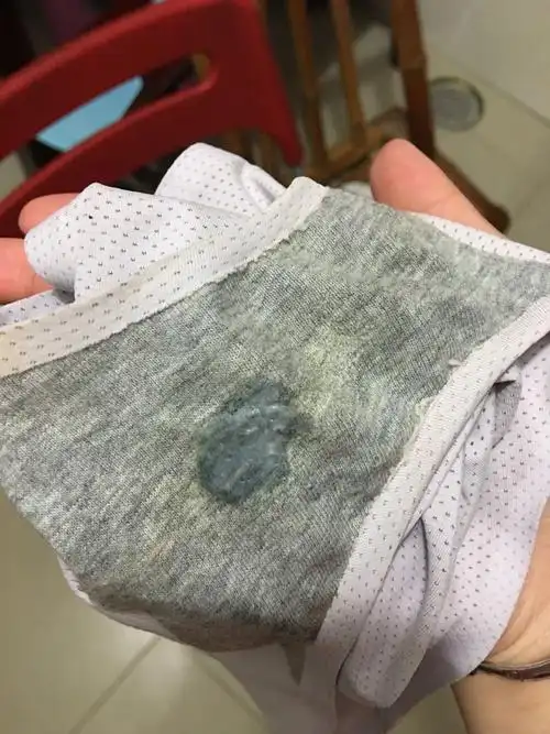 这种白带是不是有问题 无异味