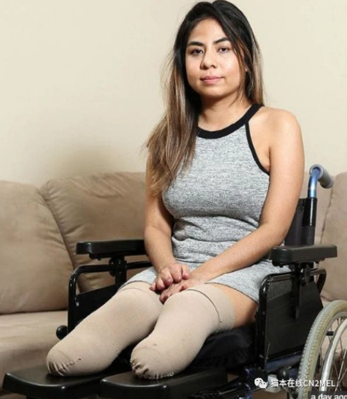 一场暴雨打了几个喷嚏澳洲女孩因此被截肢无数人因此丧命