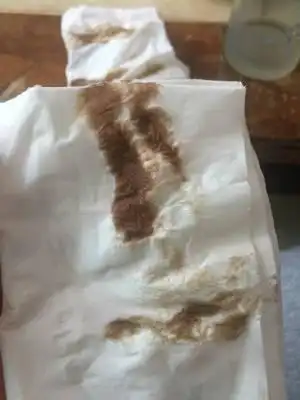 孕35天流褐色分泌物.肚子不痛.流了几天但今天颜色和量都增加了.