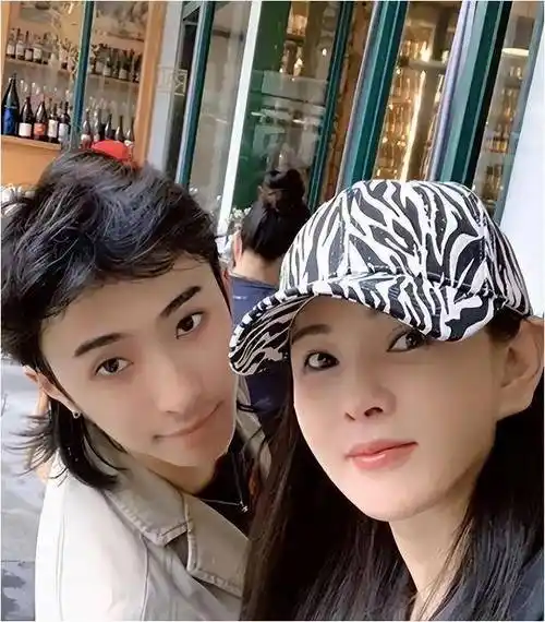 秦昊妻子韩国打水光针,伊能静56岁满脸针眼,感慨:实在太痛苦了