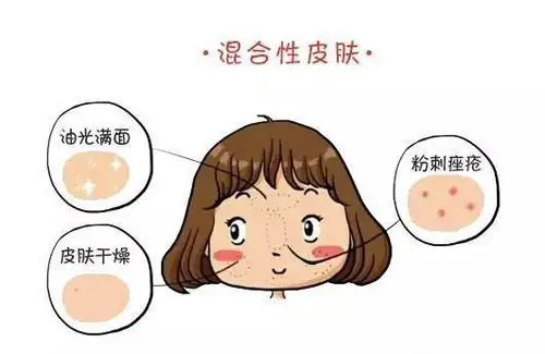 混合性皮肤怎么护理