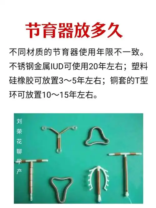 宫内节育环放置时间
