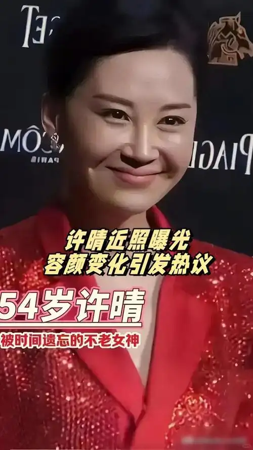 不老女神许晴罕见露面疑似医美过度模样大变网友可惜了