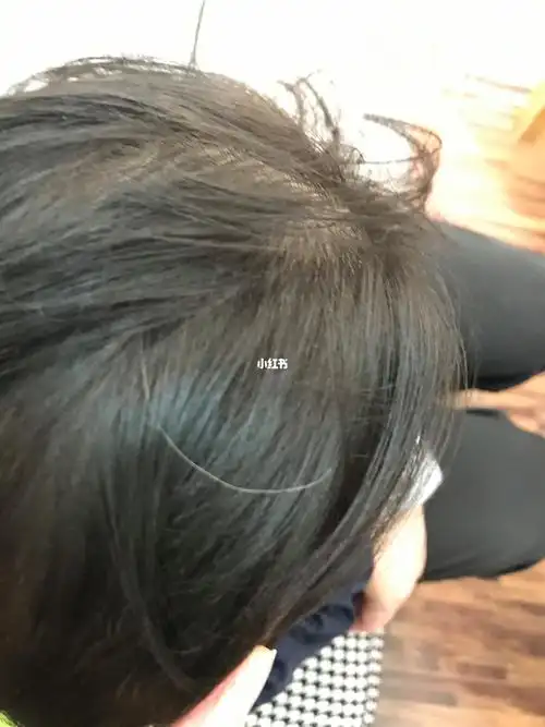 一岁的宝宝居然一根白头发05