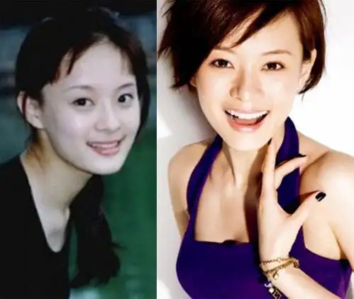 【图】孙俪整容前照片曝光 称自己曾是个丑女坦言"整过容"