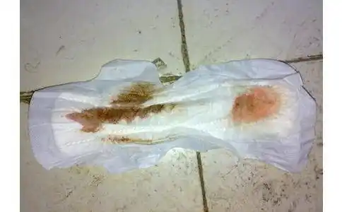 使用过的姨妈巾