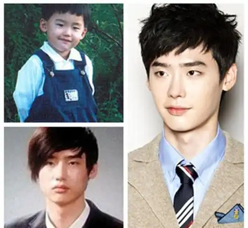 【图】李钟硕整容前图片 简直丑的认不出