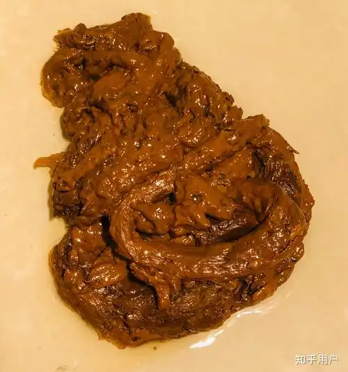 你们见过最大的屎是什么样的? - 知乎