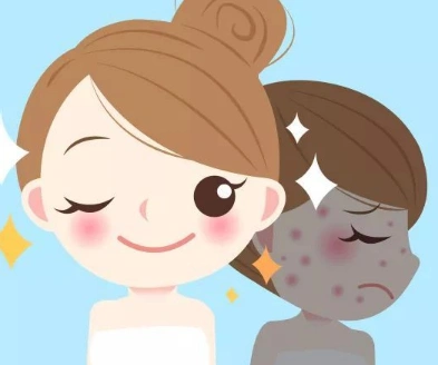 激光祛痘手术的优点有哪些激光祛痘的注意事项