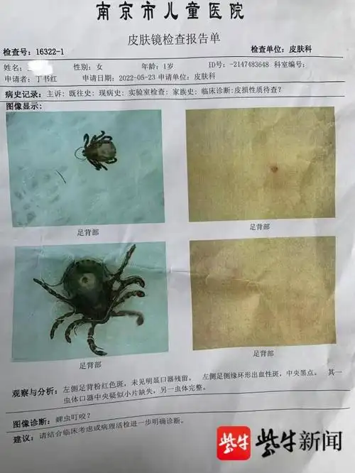 皮肤镜检查报告知名法律博主"逻格斯logics"告诉记者,一般类似的事件