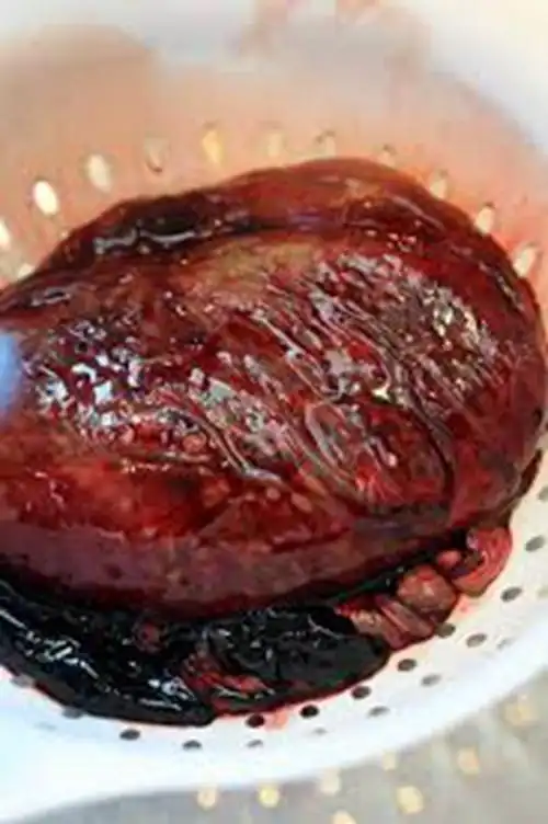 人胎盘详细的特征图片