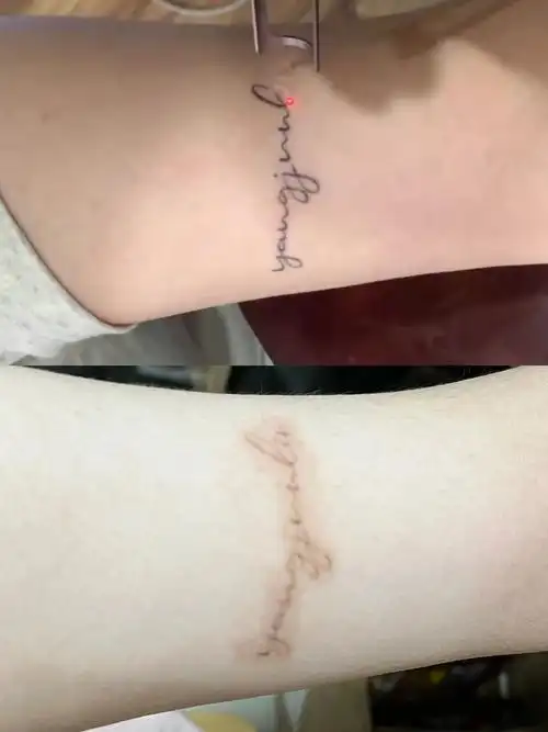 第一次清洗纹身1个月恢复情况